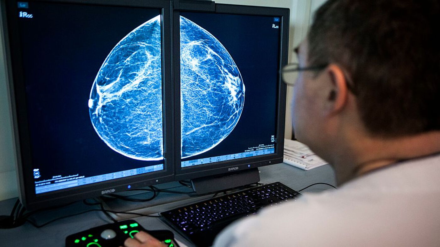 Mammograms Could Become an Early Warning System for Women’s Heart Disease
